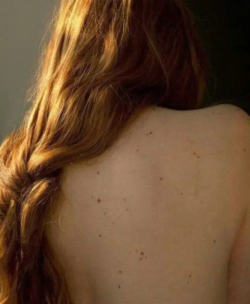 cuppingmassage amersfoort